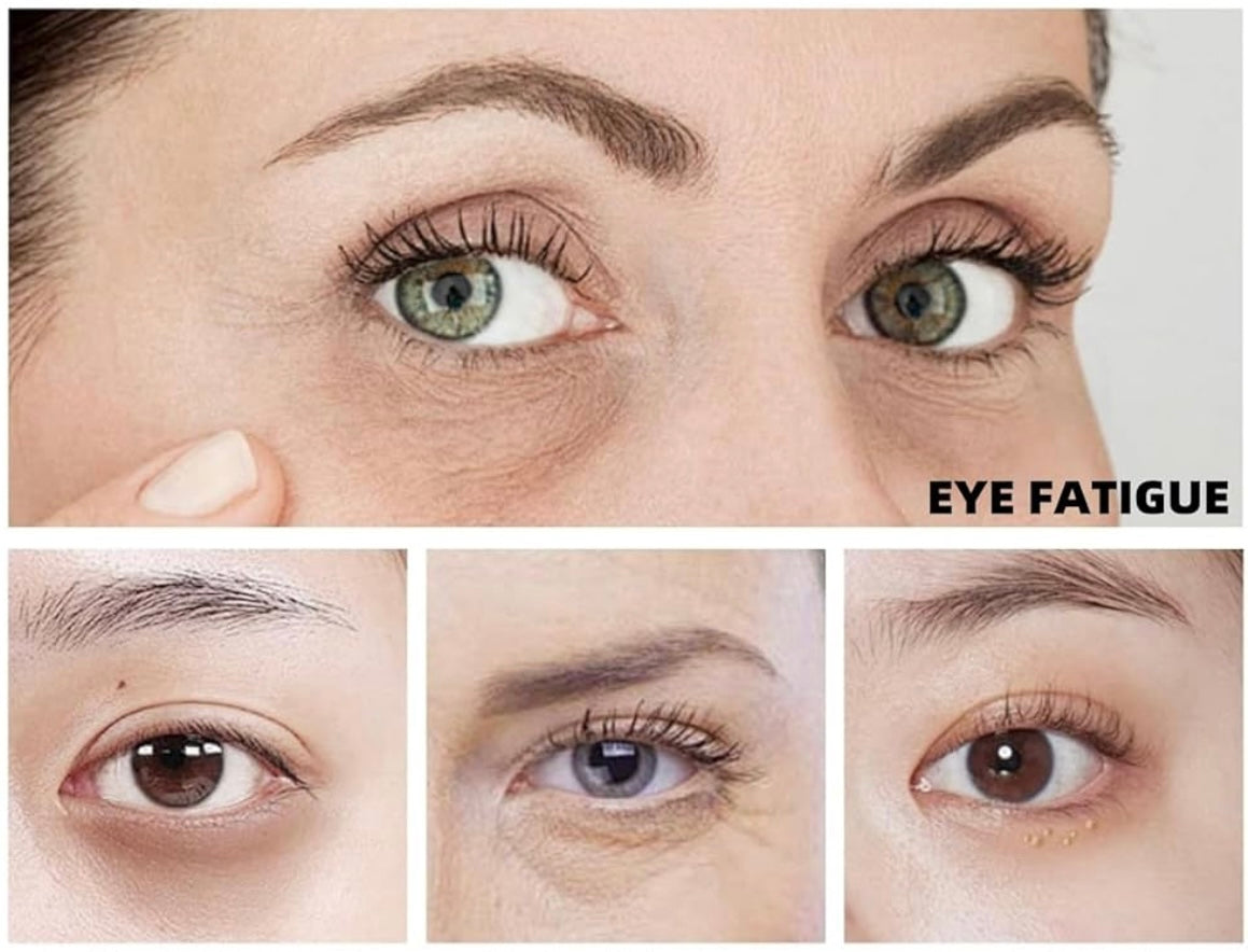 Patch Anti-Rides Yeux